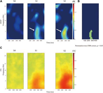 PainVision-based evaluation of brain potentials: a novel approach for quantitative pain assessment